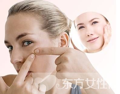 長痘痘不能吃什么 這4種食物千萬別碰