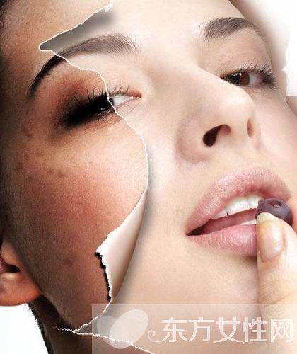 激光祛斑好不好 怎樣祛斑最有效