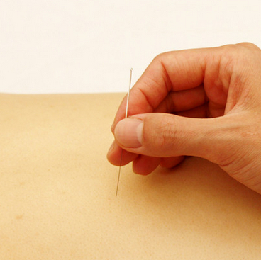 小編推薦 祛除雀斑 重塑無暇肌膚