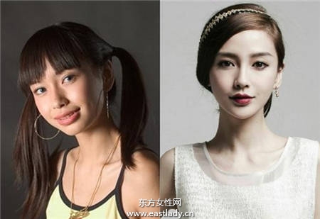 整容手術(shù)以改善咬合不正下顎突出 明星也這樣做