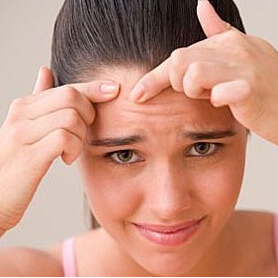 青春期如何祛痘 青春期的煩惱祛痘小絕招