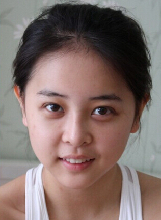 黃褐斑能去掉嗎 孕期有效預(yù)防黃褐斑的方法