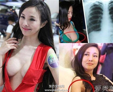 隆胸沒(méi)啥了不起 但這些女星隆胸后還死不承認(rèn)