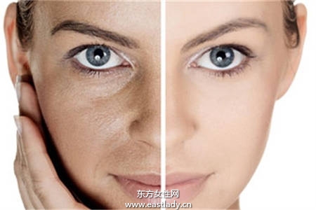 低成本擺脫皺紋  4個(gè)眼部抗皺妙招打擊女人最大天敵