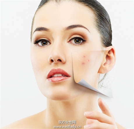 別誤會(huì) 痘痘肌最容易搞混的誤區(qū)