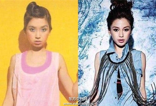 Angelababy 小S也做牙齒矯正 成功瘦小臉