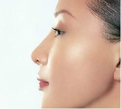 去黑眼圈最有效的4種方法