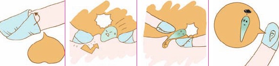 圖解實戰(zhàn)痘痘怎么消除