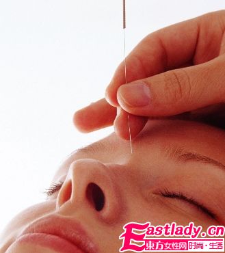 中醫(yī)針灸美容的四種療法
