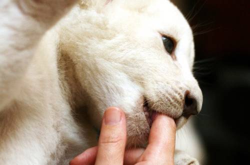 偏癱患者飲食要注意哪些 該怎么預防及預后