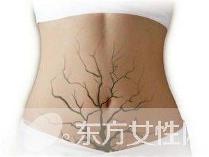 慢性便秘怎么辦 常吃這些讓你遠離它