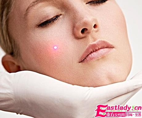 10個(gè)預(yù)防痘痘的生活常識(shí)