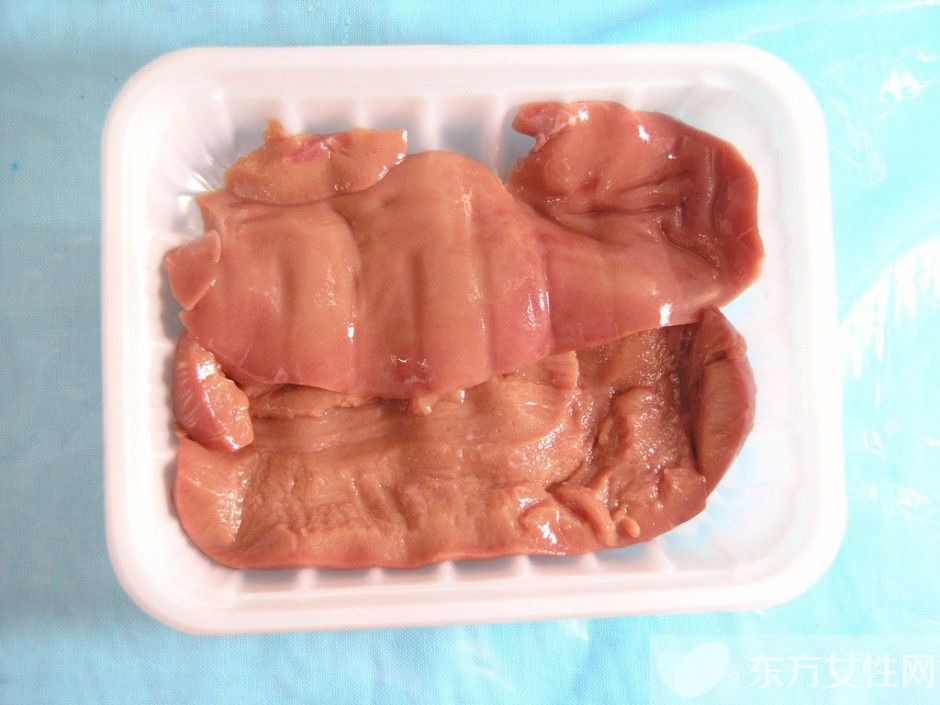 高血脂治療與飲食 這些食物吃了會(huì)嚴(yán)重影響病情哦