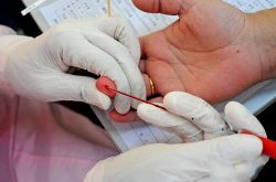 什么是高血脂癥 高血脂不得不注意的幾個(gè)方面