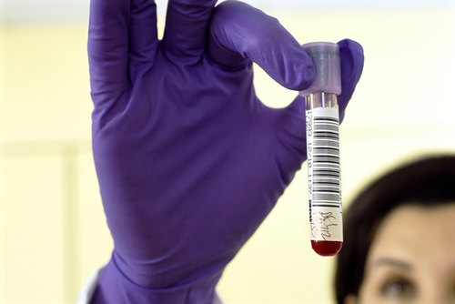 乙肝兩對半是什么 乙肝兩對半檢查對照表