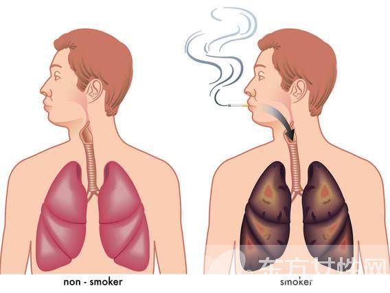 肺氣腫會(huì)傳染嗎 治療肺氣腫的食療偏方推薦