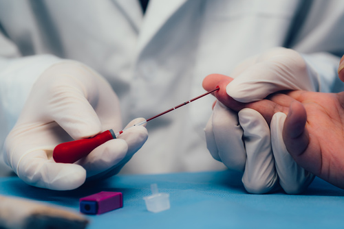 乙肝兩對半是什么 乙肝兩對半檢查對照表