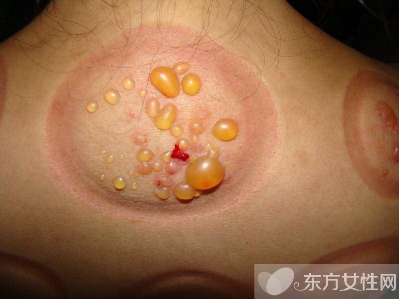 身體濕氣重怎么調(diào)理 濕氣重的主要表現(xiàn)有哪些