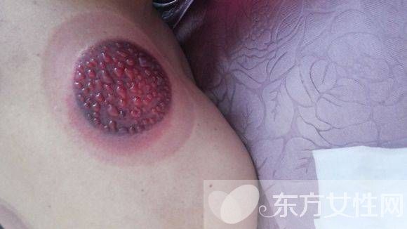 身體濕氣重怎么調(diào)理 濕氣重的主要表現(xiàn)有哪些