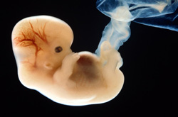 流產(chǎn)的癥狀有哪些 有什么預(yù)防措施