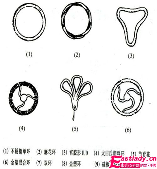 各種節(jié)育環(huán)的種類圖片介紹