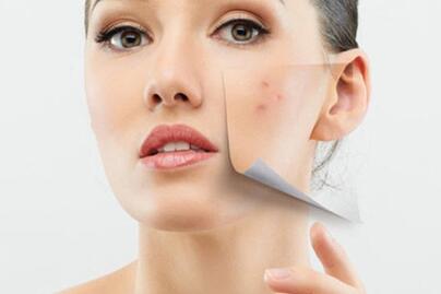 女性內(nèi)分泌失調(diào)癥狀有哪些 是什么原因造成的呢