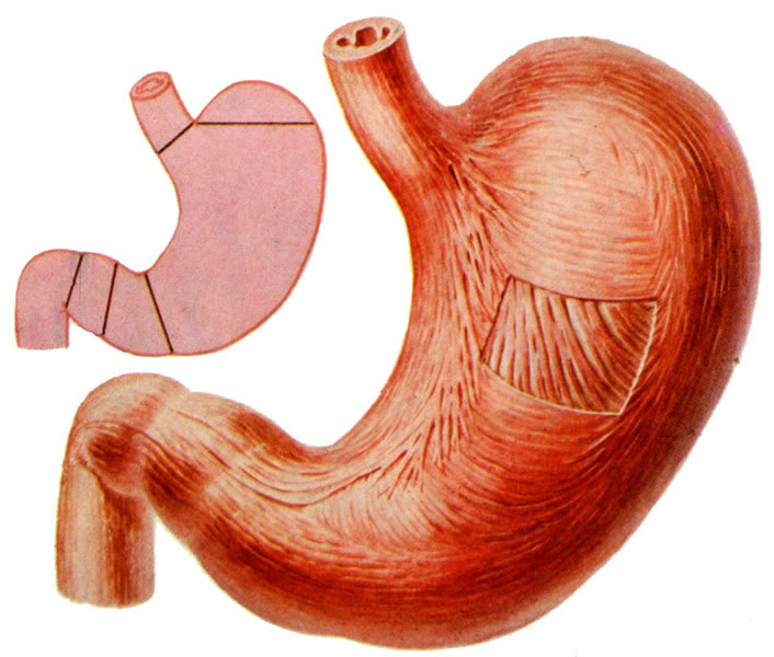 胃熱的癥狀有哪些 日常生活中該如何注意