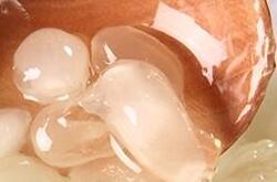 雪蓮子的功效如何 有著怎樣的神奇作用