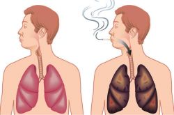 肺氣腫會(huì)傳染嗎 治療肺氣腫的食療偏方推薦