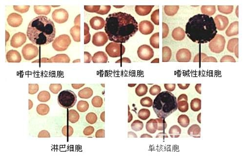 白細胞偏低的原因 白細胞低吃什么好