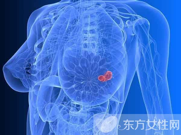 乳腺病乳腺增生癥狀表現(xiàn) 這些食物盡量少吃哦
