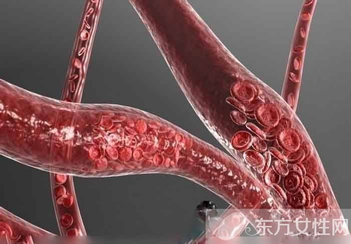 心腦血管疾病有哪些 日常飲食這些方面一定要注意