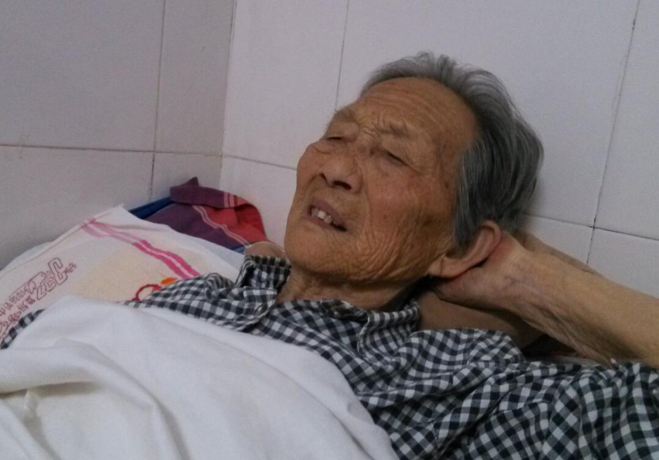 小腦萎縮的誘因及癥狀 小腦萎縮吃什么好