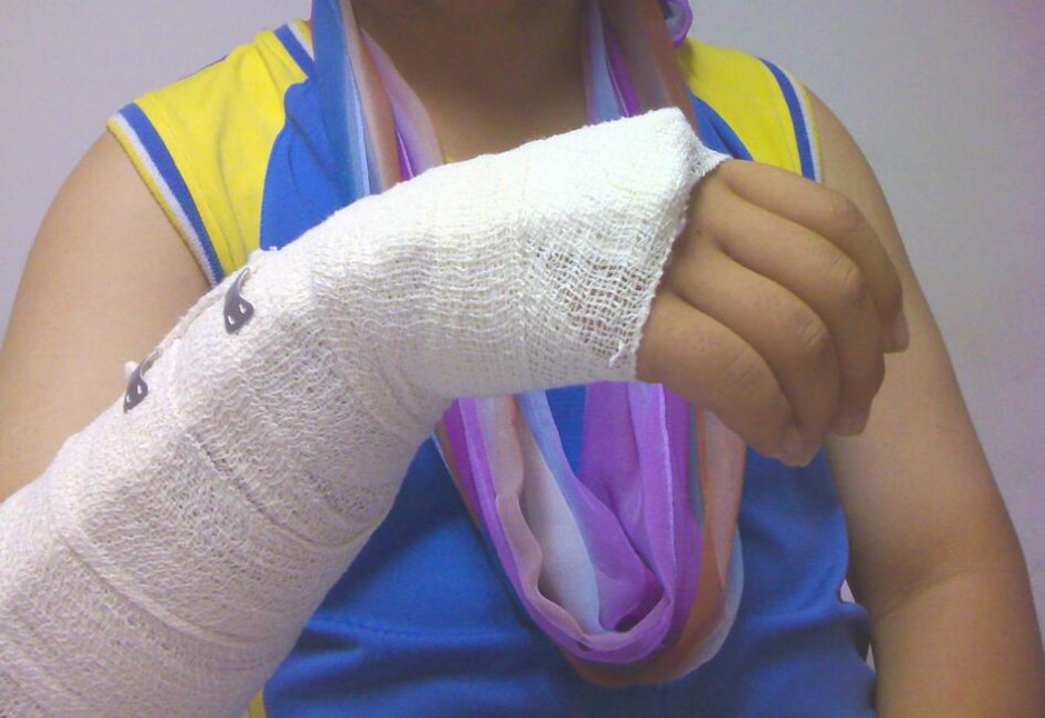 骨折愈合時(shí)間需要多久 愈合康復(fù)訓(xùn)練