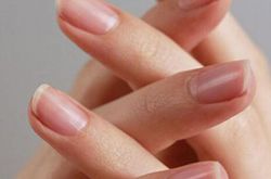 6個治療灰指甲的小偏方 灰指甲怎么預(yù)防