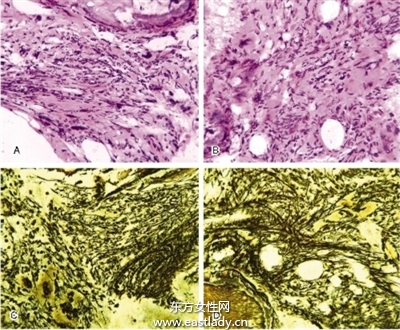 神經(jīng)官能癥能治愈嗎 神經(jīng)官能癥治療方法
