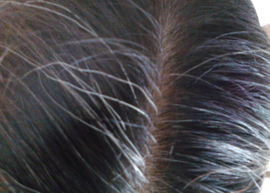 頭發(fā)變白形成原因 看哪些你已中招