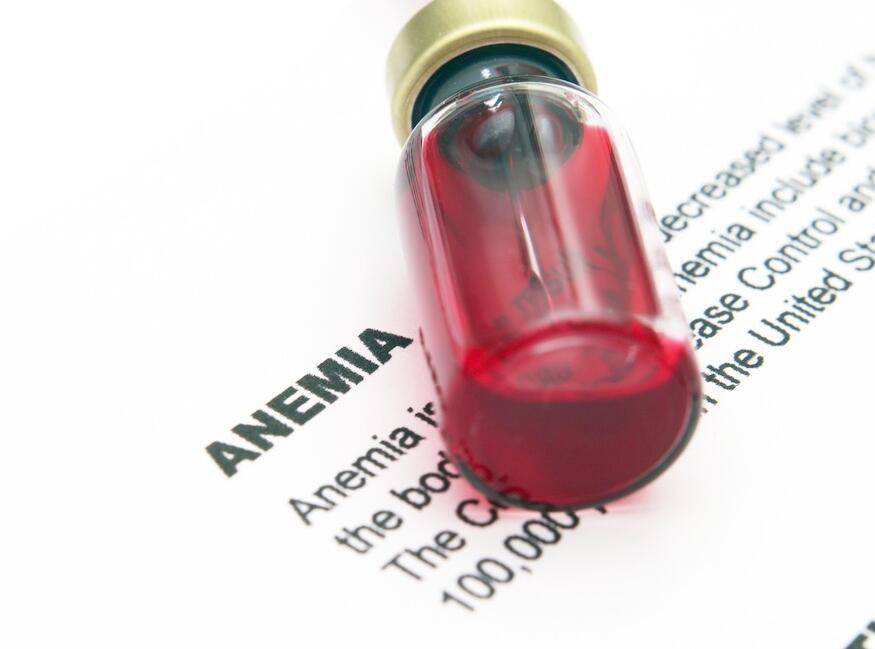 缺鐵性貧血吃什么藥 飲食保健有哪些