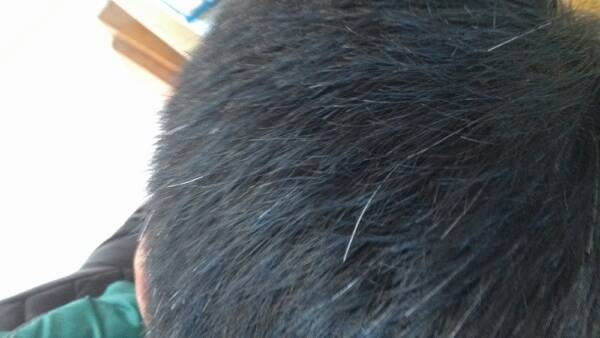 頭發(fā)變白形成原因 看哪些你已中招