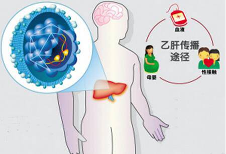 乙肝會傳染嗎 預防傳染千萬別做這些事
