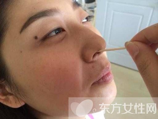 慢性鼻炎的癥狀有哪些 這些食療方法用過的都說好