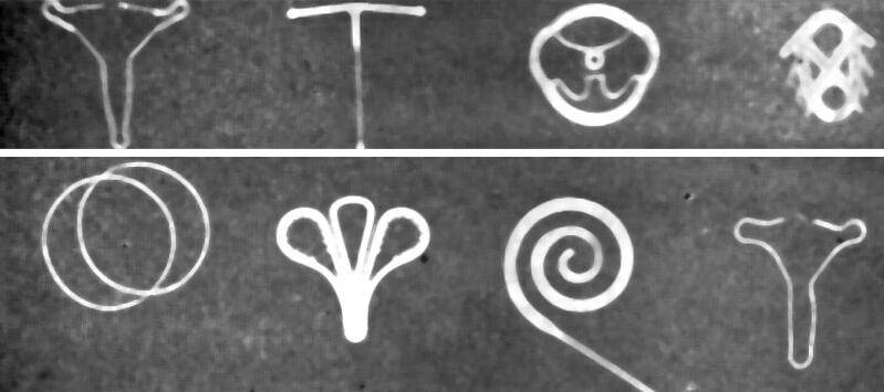 避孕環(huán)的原理有哪些 告訴你上環(huán)后的注意事項(xiàng)