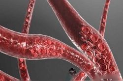 心腦血管疾病有哪些 日常飲食這些方面一定要注意