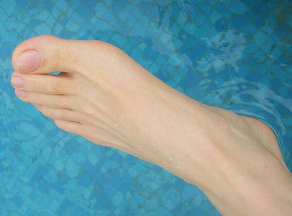 汗腳腳臭怎么辦 教您幾招去除汗腳腳臭小竅門