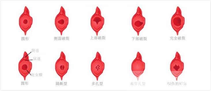 女性陰道生殖器構(gòu)造圖片 女性的陰道到底有多深