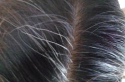 頭發(fā)變白形成原因 看哪些你已中招