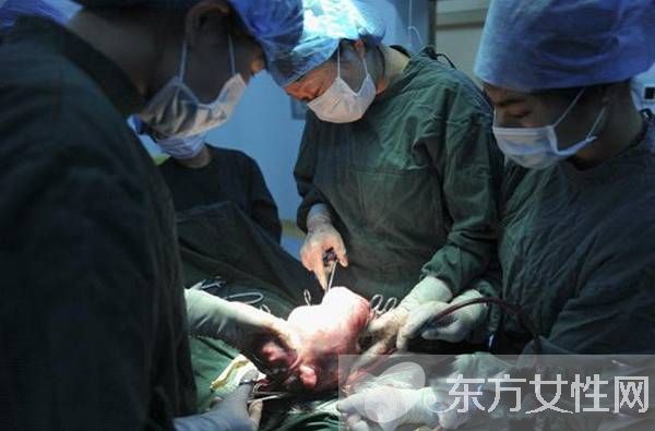 治療子宮肌瘤的偏方 這些居然是子宮肌瘤的早起癥狀