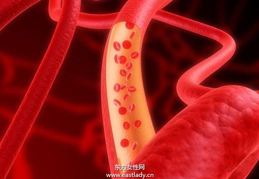 毛細(xì)血管破裂是怎么回事 揭秘毛細(xì)血管破裂的癥狀