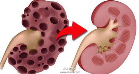學起來 10種不花錢的補腎妙方