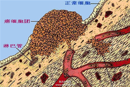 喝熱水排毒還可抗癌